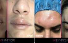 HD Esthetique