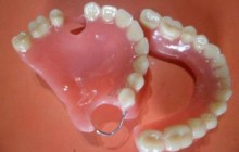 Protesis Dentales y Retenedores, Boyacá