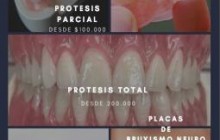 Prótesis y tratamientos odontológicos, Bogotá